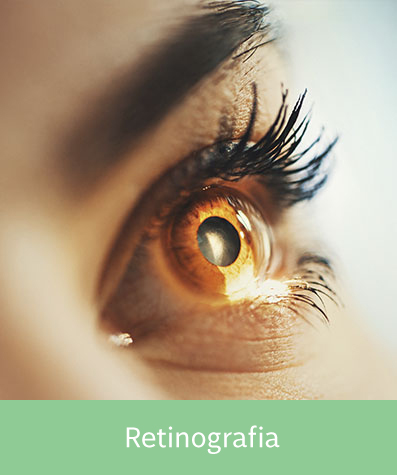 Retinografia simples 